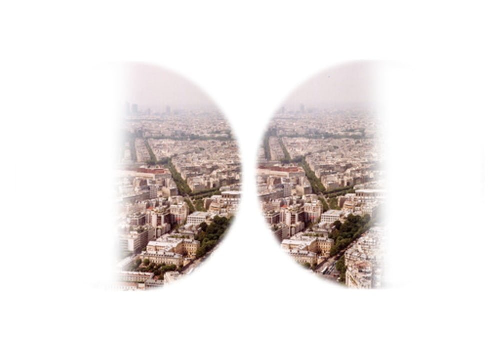 Paris as seen with bitemporal hemianopsia