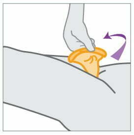To remove female condom gently twist outer ring