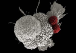 Immunotherapy Cancer Treatment | Types, To receive, Side effects