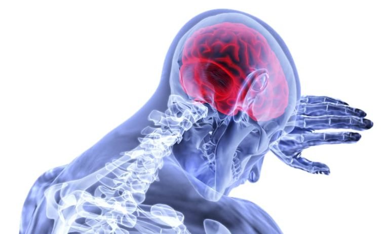 brain-damage-brain-injury-common-causes-types-and-effects